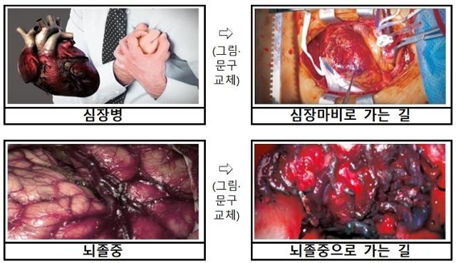 23일부터 새로 적용되는 담뱃갑 경고 그림. 보건복지부 제공