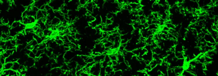 뇌의 미세아교세포를 형광 전자현미경으로 찍은 사진  미국 로체스터대 제공