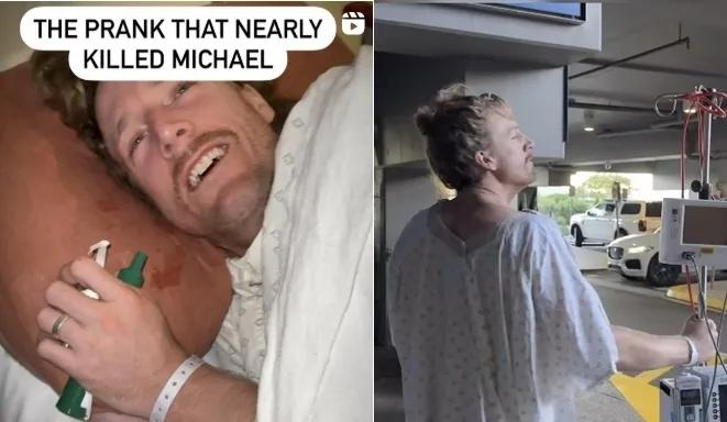 생두를 삼켜 수술을 받은 코미디 듀오 ‘마티 앤 마이클’의 마이클의 모습. 인스타그램(@martyandmichael) 캡처