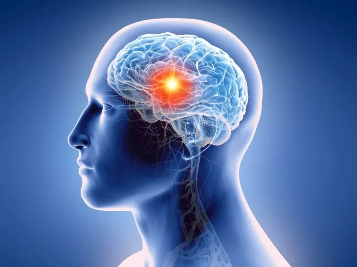 뇌종양 이미지. 미국 스탠퍼드대 의대 제공