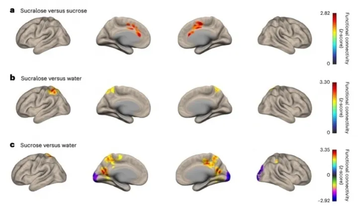 수크랄로스와 설탕(sucrose) 음료, 물 섭취 후 뇌의 변화. 네이처 메타볼리즘 논문 캡처