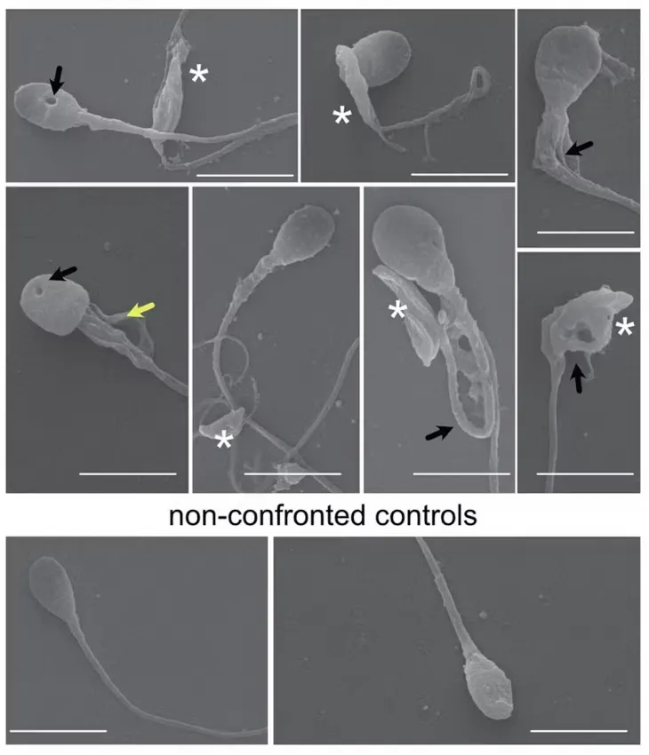 톡소포자충에 감염돼 머리 부분이 잘리거나 구조가 변형된 인간 정자(위). 아래는 정상적인 정자. FEBS 저널 논문 캡처