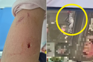 “막내딸이 대형견에 물렸는데…견주는 ‘아이가 먼저 개를 자극했다’ 합니다”