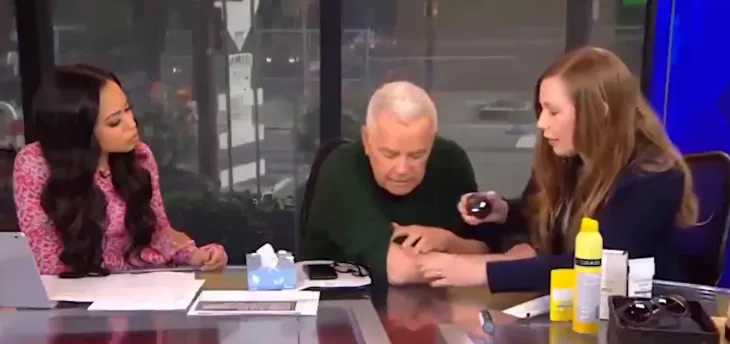 미국 피부과 전문의 조안나 워커(오른쪽) 박사가 방송 진행 도중 진행자인 마이크 제릭(가운데)의 오른쪽 팔을 보고 기저세포암이라고 진단했다. 폭스29 방송 화면 캡처