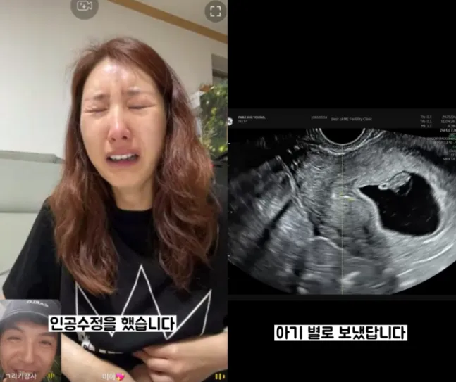 그룹 슈퍼주니어 이특의 친누나로 알려진 배우 박인영이 유산 소식을 전해 안타까움을 자아냈다. 박인영 인스타그램 캡처