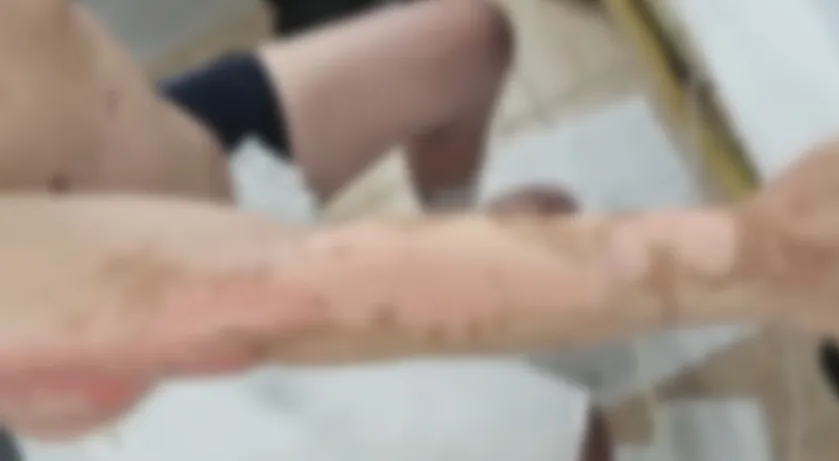 지난 5일 대전 서구의 한 빌라에서 60대 A씨가 층간소음 문제를 알아보러 온 이웃에게 뜨거운 식용유를 끼얹고 흉기로 위협한 사건이 발생했다. 경찰이 A씨를 특수상해 및 특수협박 혐의로 구속영장을 신청한 가운데, 피해자는 전신 3도 화상을 입었다. 자료 : TJB뉴스