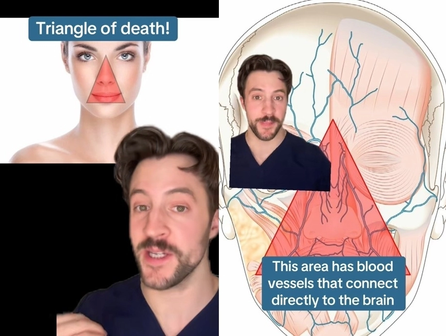 미국 피부과 전문의 마크 스트롬 박사가 얼굴 중앙에 있는 ‘죽음의 삼각형’ 부위에 대해 설명하는 모습. 틱톡 캡처