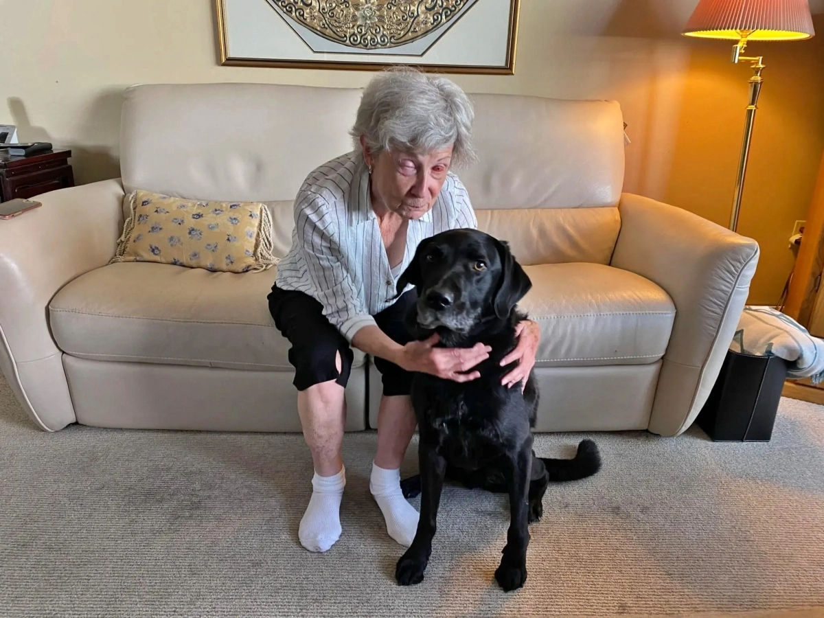 9일(현지시간) 캐나다 CBC뉴스에 따르면 10년 전 자가면역질환(스티븐스-존슨 증후군)으로 실명에 이른 게일 레인(75)은 지난 2월 송곳니를 갈아 만든 눈을 이식하고 시력을 갖게 됐다. 게일 레인 본인 제공