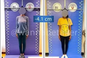 “연애하고 싶어, ‘이것’ 좀 줄여주세요” 축소술 받으러 해외원정 나서는 여성들