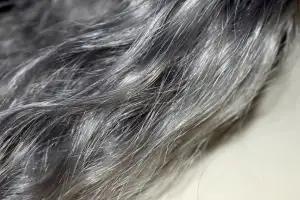 “주사 맞고, 흰머리 검게 변했다”…中서 ‘백발 주사’ 인기