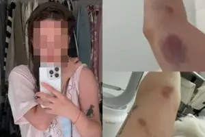 “홍대서 헌팅 거절한 뒤 폭행당해” 폭로한 대만 여성…가해자는 한국인