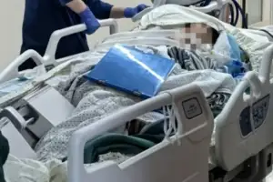 “뼈 녹이는 물”…산책 중 ‘이것’ 밟았다가 5일 만에 사망한 50대 여성 ‘中 충격’