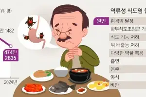 한가위 밥상 한가득 먹다간… 신물에, 쓰림에 욱! 가슴 칩니다