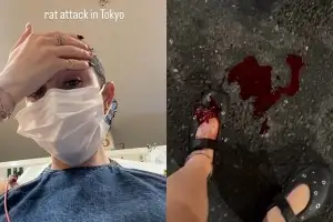 “도쿄서 미친 경험” 여행객 피 철철…‘이것’ 속수무책? 日 충격 근황