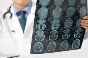 “흔한 ‘이 증상’ 방치했더니 뇌종양”…놓치면 후회할 몸의 경고 7가지