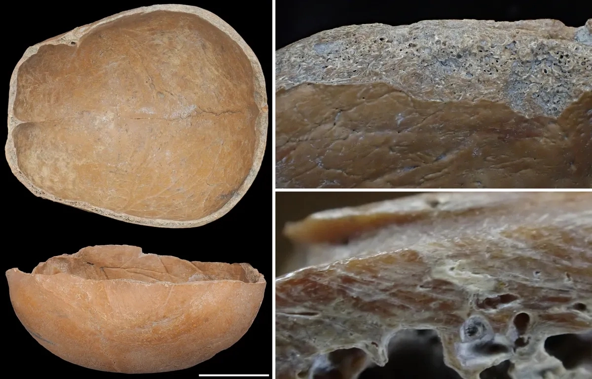 중국 신석기 시대 문명인 ‘량주 문화’ 유적지에서 발굴된 사람 두개골 유물 중 인위적으로 가공한 흔적과 함께 ‘바가지’ 형태로 가공된 두개골 2점. 사이언티픽 리포트 캡처