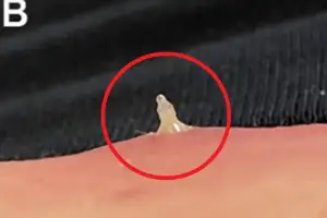 빨래 ‘이렇게’ 하다간 큰일?…기생충 ‘드글드글’ 피부까지 파고든다