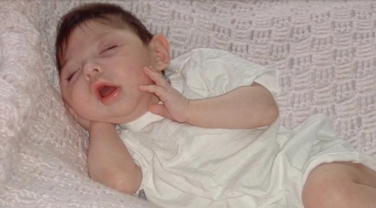 7일(현지시간) 미국 abc뉴스 계열 KETV는 네브래스카주 오마하에 사는 알렉스 심슨이 지난 4일 20세 생일을 맞았다고 전했다. 2025.11.7 KETV 화면