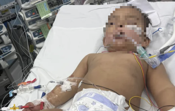 지난 5월 가정용 배수구 세정제를 우유인 줄 알고 마셨다가 중환자실에 입원했던 샘 안와르 알샤메리(당시 생후 13개월)의 모습. 온라인 모금 사이트 ‘고 펀드 미’ 캡처