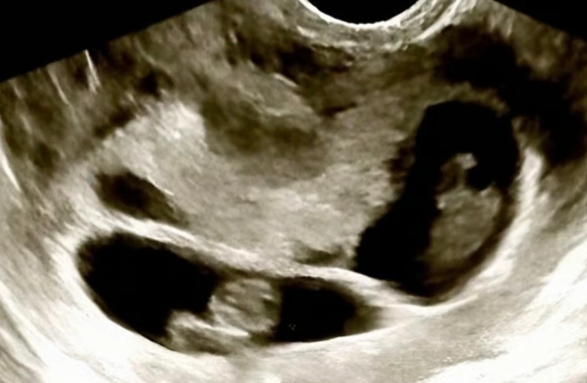 대만의 한 동성 부부가 멕시코에서 대리모를 통해 네 쌍둥이를 얻었다는 소식이 알려지면서 논란이 일고 있다. 인스타그램 캡처