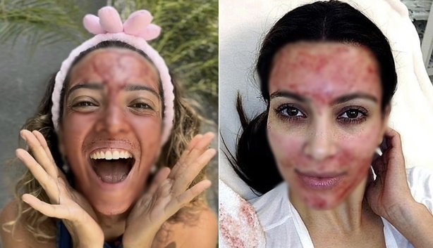 얼굴에 생리혈을 바른 인플루언서 사라 솔(왼쪽)과 ‘뱀파이어 얼굴(PRP 주사)’ 시술을 한 킴 카다시안. SNS 캡처