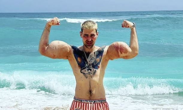 가짜 근육으로 ‘러시아 뽀빠이’라는 별명을 얻은 키릴 테레신(29). 인스타그램 캡처