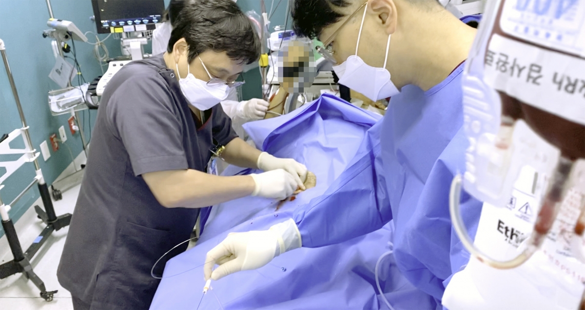 충남권역외상센터 의료진들이 외상성 심정지 환자에게 레보아 시술을 하고 있다. 단국대병원 제공