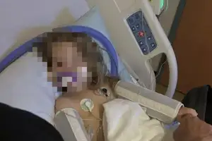 thumbnail - “이렇게 심할 줄 몰랐다”…친척들 ‘뽀뽀 세례’ 받은 2살 중환자실행, 무슨 일