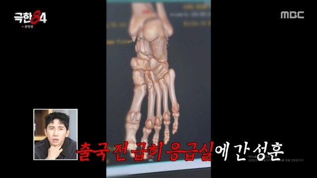 MBC 예능 ‘극한84’ 방송화면 캡처