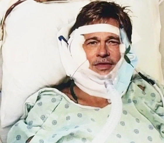 사칭범이 치료비를 요구하며 보내 온 브래드피트의 AI 합성 사진. 엑스