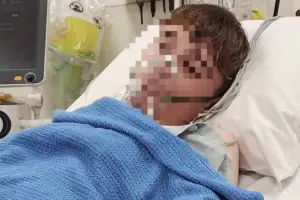 “3년간 전자담배 달고 살았다”…병원 실려 간 10대, 폐 조직 절제한 사연