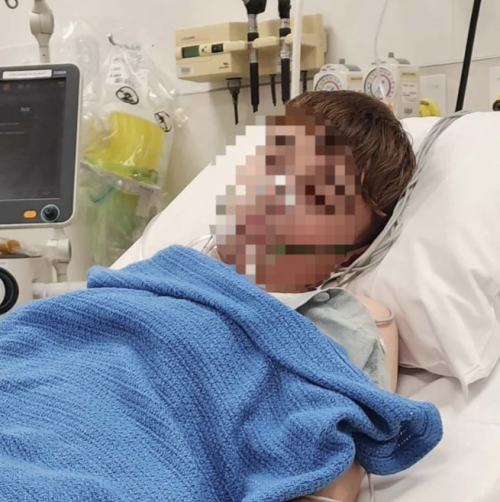 3년간 전자담배를 피우다가 결국 손상된 폐 조직의 일부를 절제하는 수술을 받은 뉴질랜드 출신 리레이 킹(17). 더선 캡처