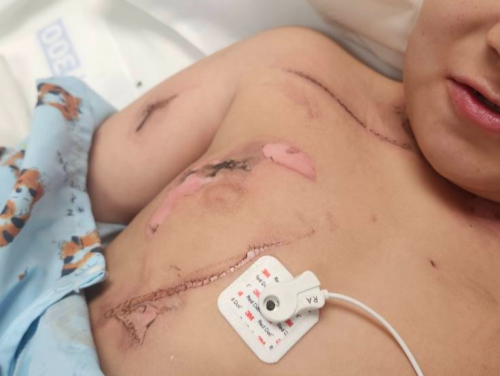 지난달 침대 위에서 감전 사고를 겪은 8살 소년 로렌조 로페즈. 온라인 모금 사이트 ‘고펀드미’ 캡처