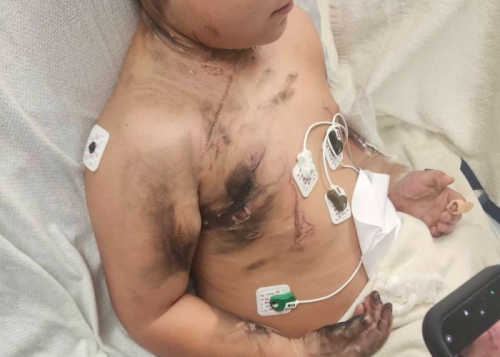 지난달 침대 위에서 감전 사고를 겪은 8살 소년 로렌조 로페즈. 온라인 모금 사이트 ‘고펀드미’ 캡처