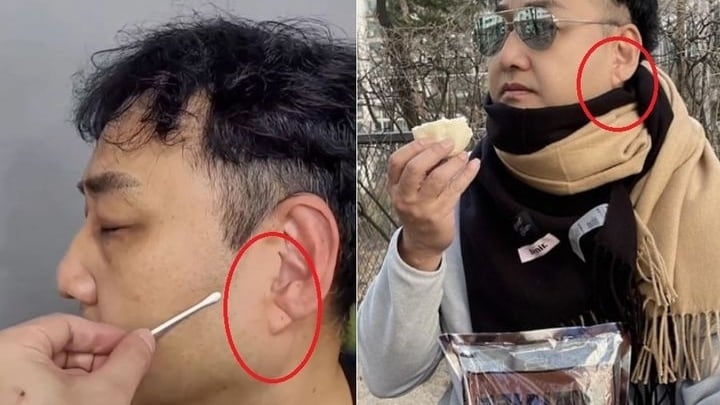 개그맨 김수용(59)이 최근 갑자기 의식을 잃고 쓰러져 급성 심근경색을 진단받은 가운데, 그의 귓불에 있던 사선 주름이 전조증상이라는 주장이 제기됐다. 김수용 인스타그램 캡처