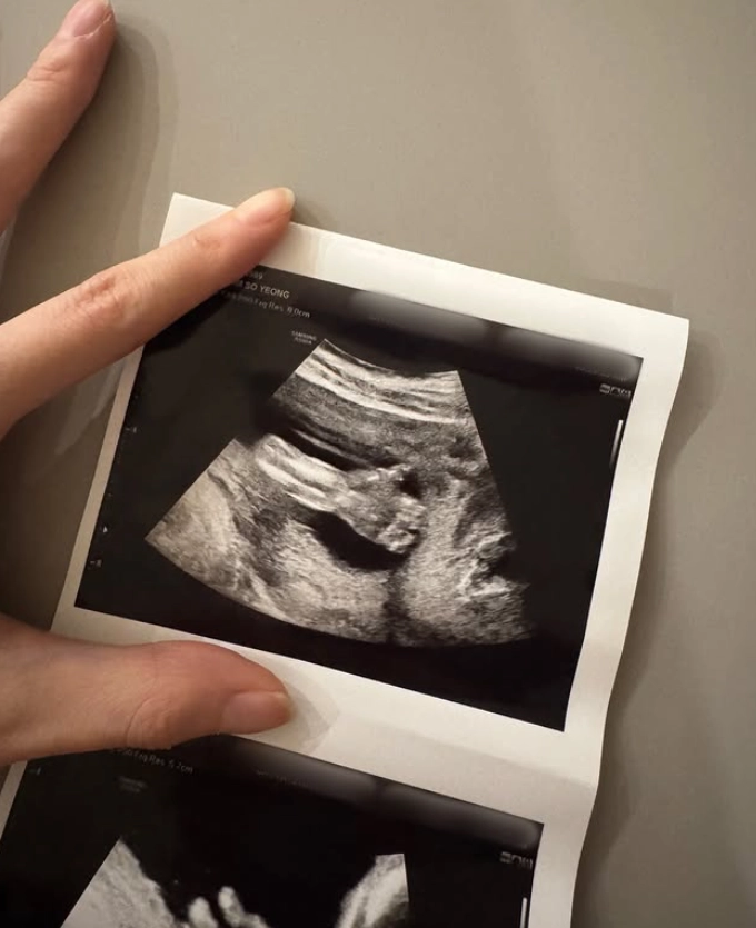 아나운서 출신 방송인 오상진(45)·김소영(38) 부부가 둘째를 품에 안게 됐다. 인스타그램 캡처