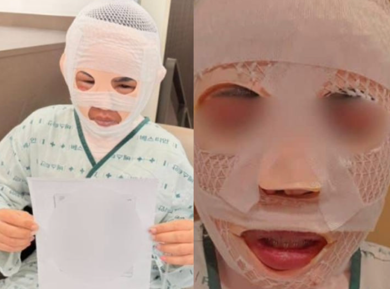 잠을 자고 있던 태국인 아내의 얼굴에 끓는 물을 부어 화상을 입힌 40대 한국인 남성이 경찰에 붙잡혔다. 페이스북