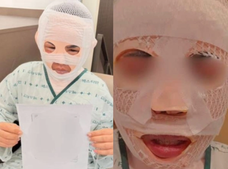 잠을 자고 있던 태국인 아내의 얼굴에 끓는 물을 부어 화상을 입힌 40대 한국인 남성이 경찰에 붙잡혔다. 이 남성은 아내가 다른 남성을 만나는 것이 두려워 이 같은 범행을 저질렀다고 주장했다. 페이스북