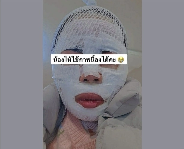 잠을 자고 있던 태국인 아내의 얼굴에 끓는 물을 부어 화상을 입힌 40대 한국인 남성이 경찰에 붙잡혔다. 이 남성은 아내가 다른 남성을 만나는 것이 두려워 이 같은 범행을 저질렀다고 주장했다. 페이스북