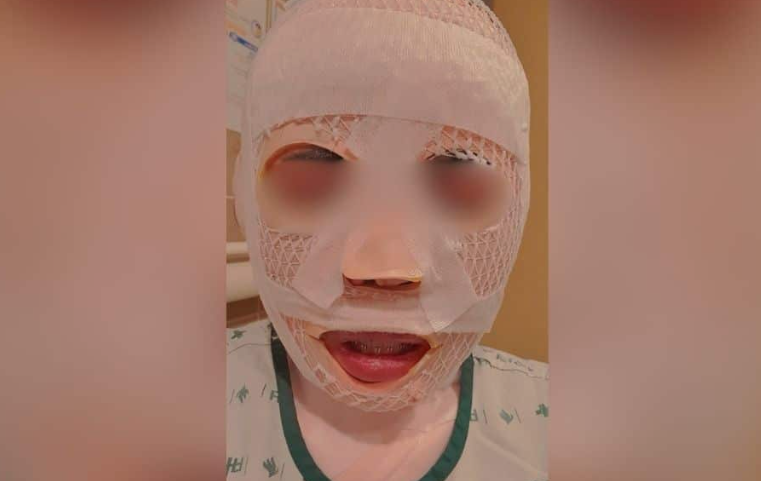 잠을 자고 있던 태국인 아내의 얼굴에 끓는 물을 부어 화상을 입힌 40대 한국인 남성이 경찰에 붙잡혔다. 이 남성은 아내가 다른 남성을 만나는 것이 두려워 이 같은 범행을 저질렀다고 주장했다. 페이스북