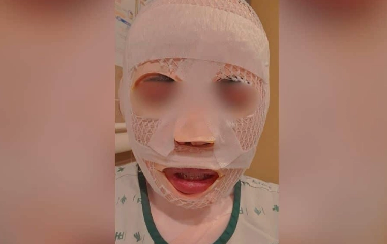 잠을 자고 있던 태국인 아내의 얼굴에 끓는 물을 부어 화상을 입힌 40대 한국인 남성이 경찰에 붙잡혔다. 이 남성은 아내가 다른 남성을 만나는 것이 두려워 이 같은 범행을 저질렀다고 주장했다. 페이스북