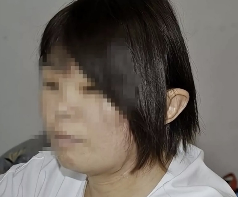 중국에서 사고로 뜯겨나간 한 여성의 귀를 발등에 5개월간 임시 이식한 사연이 전해졌다. 미러 캡처