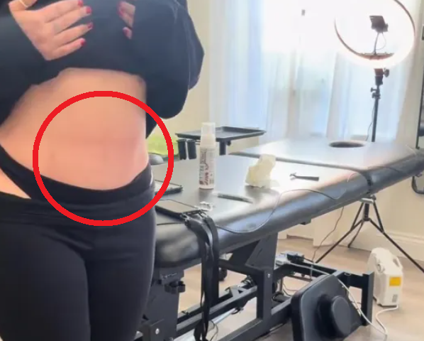 영국의 한 타투이스트가 복부 성형 수술로 배꼽을 잃은 친구를 위해 ‘배꼽 타투’를 새겨준 사연이 전해져 눈길을 끌고 있다. 틱톡 캡처