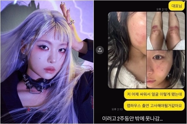 래퍼 재키와이가 프로듀서인 방달로부터 데이트 폭력을 당했다고 주장했다. AOMG·SNS 캡처