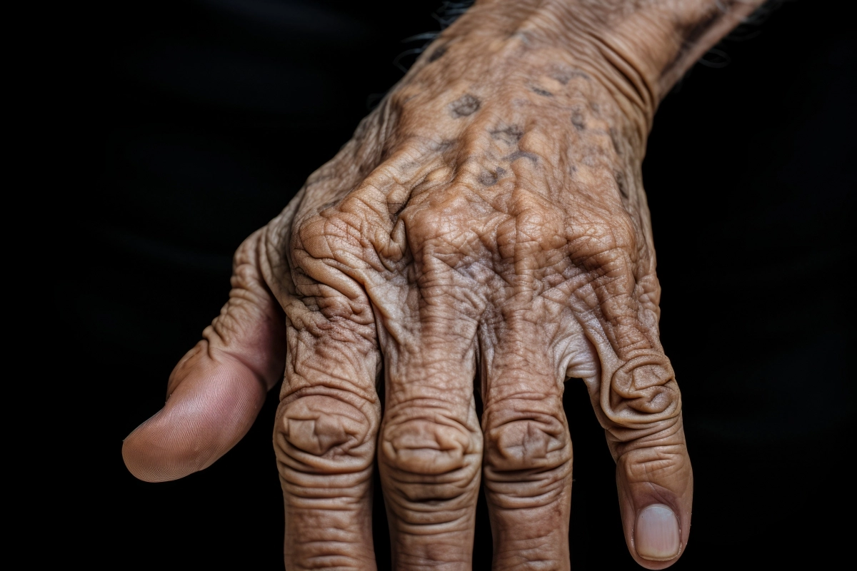 주름이 깊게 패인 노인의 손. 123rf