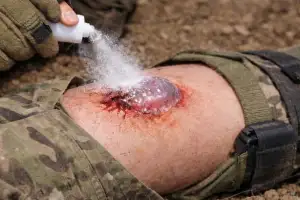 thumbnail - 뿌리면 1초 만에 지혈…韓연구진이 개발한 ‘파우더 지혈제’ 정체