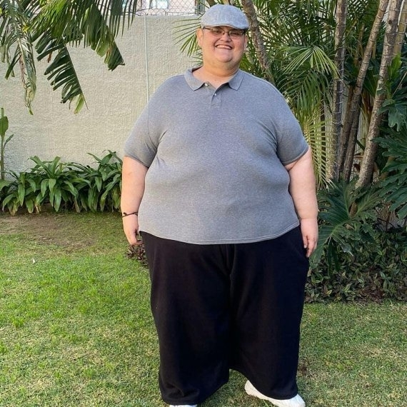 체중 감량에 성공한 후안 페드로 프랑코. 인스타그램 캡처