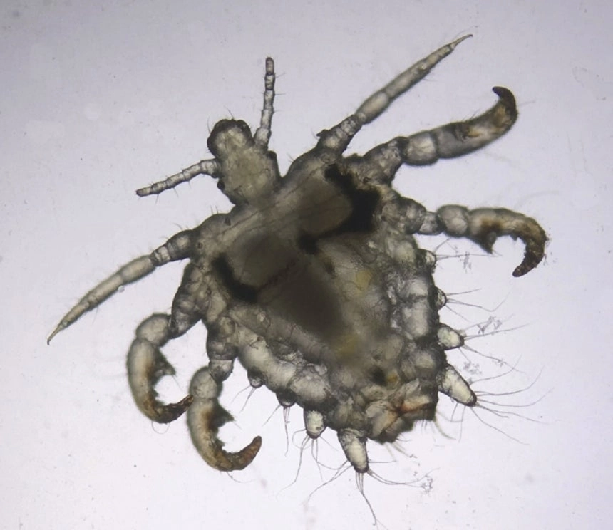 사면발이는 성관계 등에 의해 생식기 근처 체모에 감염될 수 있으며, 주로 가려움증을 유발한다. ‘Dermoscopy of pediculosis pubis’ 논문 캡처