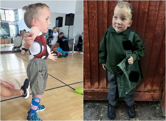 생후 2개월 만에 희귀 유전자 질환인 척수성 근위축증(SMA) 진단을 받은 영국의 5세 소년이 치료제 ‘졸겐스마(Zolgensma)’를 투여받은 지 4년 만에 기적적으로 걷게 됐다. SNS 캡처