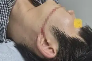 “워터건에 얼굴 다쳐” 물축제서 피 흘린 대학생… 관계자 무더기 송치